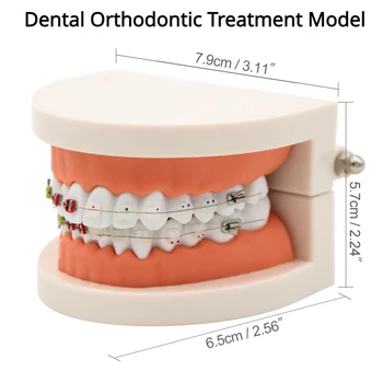 Модель для ортодонтического лечения зубов с керамическим кронштейном Arch Wire Ortho Metal Ортодонтические Зубчатые стоматологические инструменты Стоматологическая лаборатория